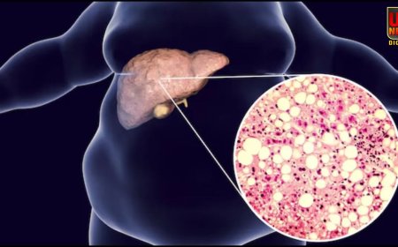 IIT कानपुर का कमाल: फैटी लिवर के इलाज के लिए बना क्रांतिकारी स्प्रे, लाखों मरीजों को नई उम्मीद
