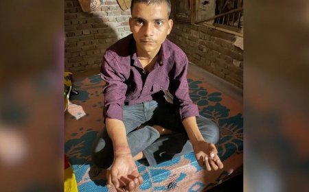 अब कैसे लिखूं पेपर… आगरा में छात्र को पुलिस ने दी थर्ड डिग्री, पिटाई से टूटा हाथ, दो दारोगा सस्पेंड