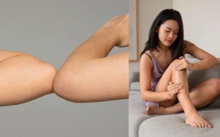 कोहनी और घुटनों का कालापन कैसे दूर करें? जानिए आसान घरेलू उपाय