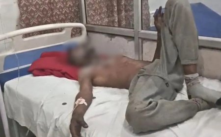 बाइक के लिए थाने के चक्कर काटता रहा डिलीवरी बॉय… परेशान होकर गेट पर खुद को लगाई आग, पुलिस पर उठे सवाल