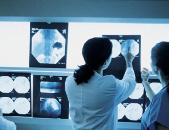 जिला अस्पताल में वसूली का खुलासा, एक्सरे टेक्नीशियन पर 100 रुपये घूस लेने का मुकदमा दर्ज