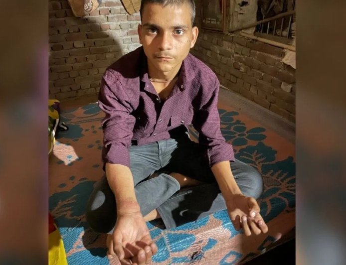 अब कैसे लिखूं पेपर… आगरा में छात्र को पुलिस ने दी थर्ड डिग्री, पिटाई से टूटा हाथ, दो दारोगा सस्पेंड