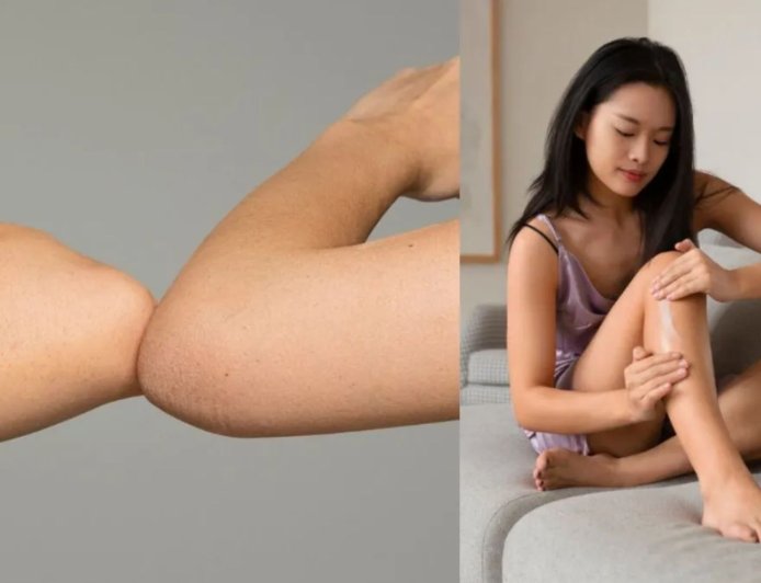 कोहनी और घुटनों का कालापन कैसे दूर करें? जानिए आसान घरेलू उपाय