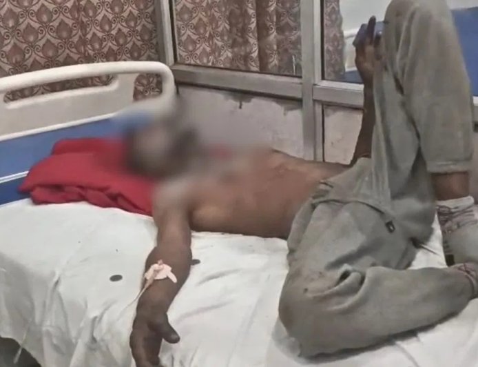 बाइक के लिए थाने के चक्कर काटता रहा डिलीवरी बॉय… परेशान होकर गेट पर खुद को लगाई आग, पुलिस पर उठे सवाल