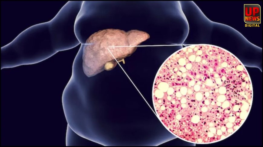 IIT कानपुर का कमाल: फैटी लिवर के इलाज के लिए बना क्रांतिकारी स्प्रे, लाखों मरीजों को नई उम्मीद