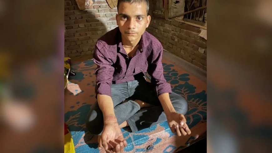 अब कैसे लिखूं पेपर… आगरा में छात्र को पुलिस ने दी थर्ड डिग्री, पिटाई से टूटा हाथ, दो दारोगा सस्पेंड