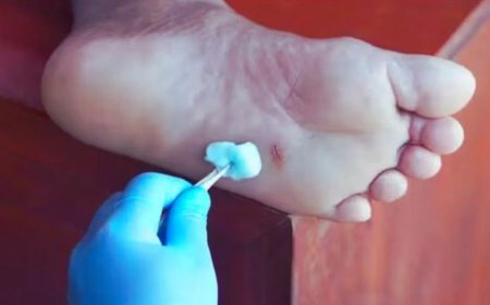 कमिश्नर की पत्नी के इलाज के लिए पहुंचा डॉक्टर, नशे में होने का आरोप… DM के आदेश पर शुरू हुई जांच