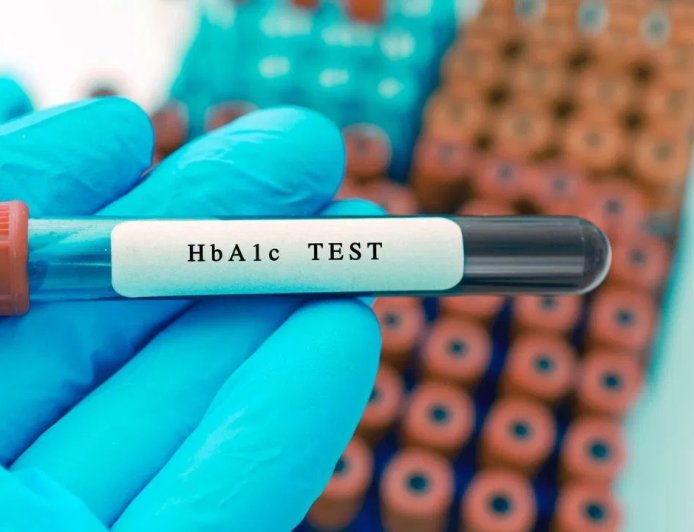 डायबिटीज मरीज ध्यान दें… कितने महीने में कराना चाहिए HbA1c टेस्ट, डॉक्टर ने बताया सही समय
