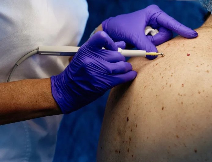 बार-बार हो रहा स्किन इंफेक्शन? हो सकता है बड़ी बीमारी का संकेत, डॉक्टरों ने दी चेतावनी