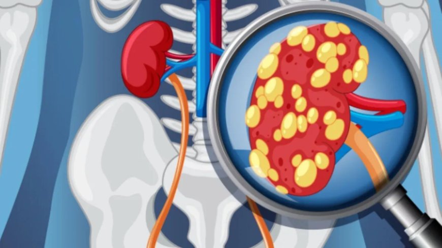 साइलेंट पैंडेमिक बन रही प्रोग्रेसिव किडनी डिजीज, समय रहते जांच और योग से बचाव संभव