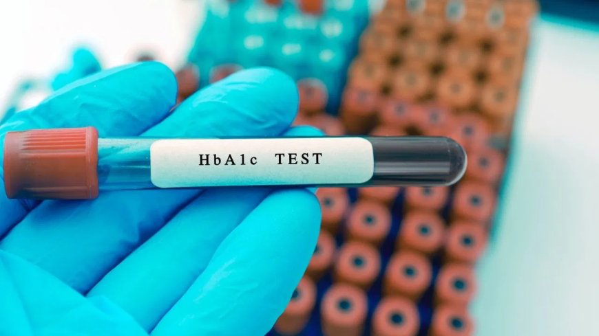 डायबिटीज मरीज ध्यान दें… कितने महीने में कराना चाहिए HbA1c टेस्ट, डॉक्टर ने बताया सही समय