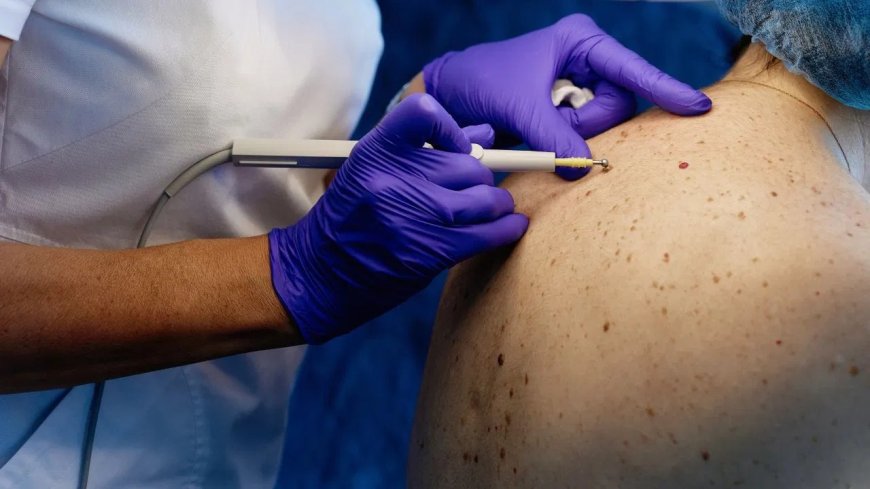 बार-बार हो रहा स्किन इंफेक्शन? हो सकता है बड़ी बीमारी का संकेत, डॉक्टरों ने दी चेतावनी