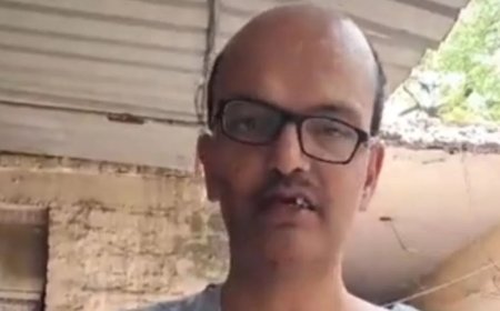 कब बनेगी ये सड़क? सवाल पूछते ही गुस्साए दुकानदार ने शख्स के तोड़े तीन दांत, फिर हाथ में देकर बोला– हां बन रही है