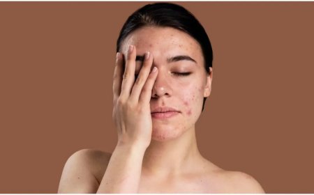 बेसन और दही का फेस पैक देगा दाग-धब्बों से छुटकारा, घर बैठे पाएं निखरी त्वचा