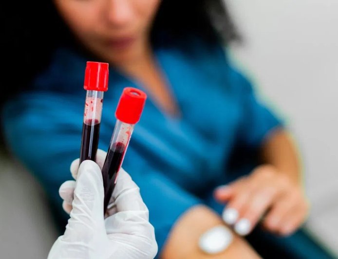 ब्लड टेस्ट के लिए होम सैंपल या लैब विजिट? डॉक्टरों ने बताया सबसे सही तरीका