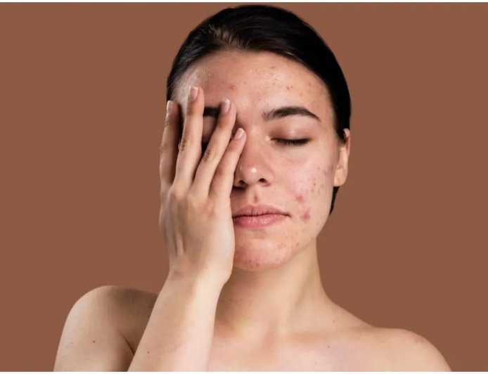 बेसन और दही का फेस पैक देगा दाग-धब्बों से छुटकारा, घर बैठे पाएं निखरी त्वचा