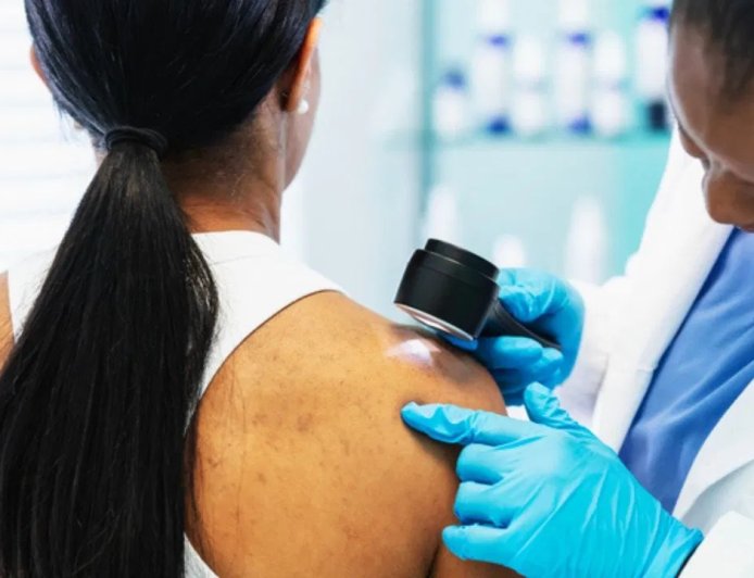 गर्मियों में बढ़ सकता है स्किन कैंसर का खतरा, जानिए कारण, लक्षण और बचाव के आसान उपाय