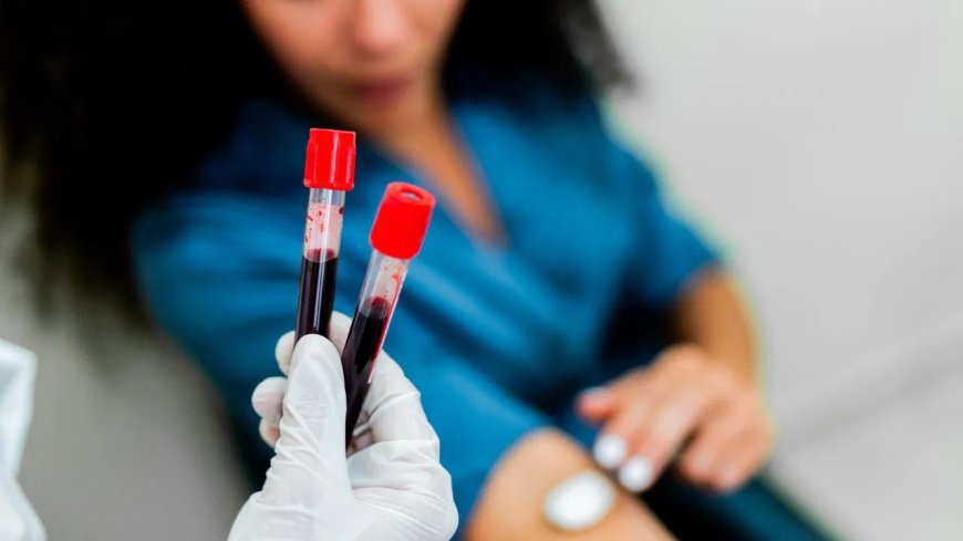 ब्लड टेस्ट के लिए होम सैंपल या लैब विजिट? डॉक्टरों ने बताया सबसे सही तरीका