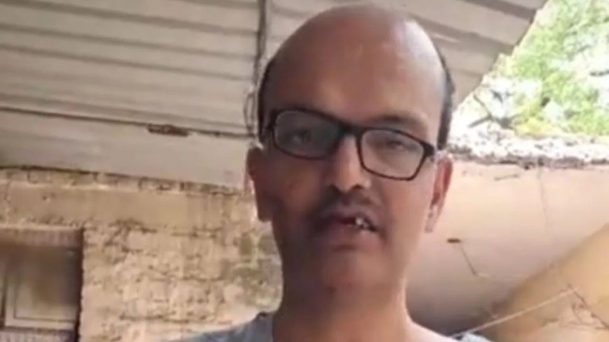 कब बनेगी ये सड़क? सवाल पूछते ही गुस्साए दुकानदार ने शख्स के तोड़े तीन दांत, फिर हाथ में देकर बोला– हां बन रही है