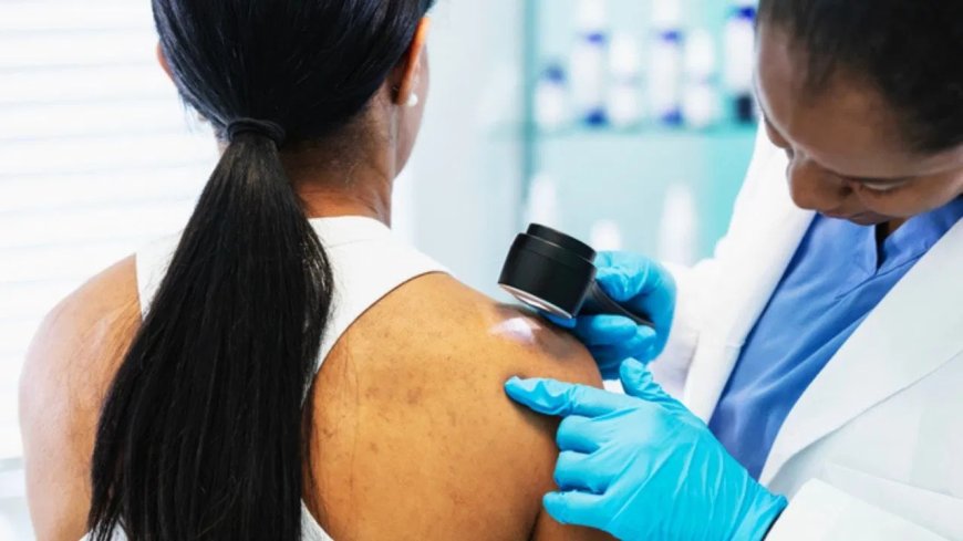 गर्मियों में बढ़ सकता है स्किन कैंसर का खतरा, जानिए कारण, लक्षण और बचाव के आसान उपाय