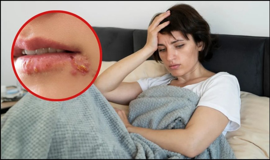 बुखार के बाद होंठों पर दाने क्यों निकलते हैं? जानिए कारण और आसान इलाज