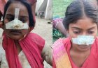 मायके जाने की जिद पर अड़ी पत्नी तो पति ने काट दी नाक,  बेटी का दर्द देख मां ने ससुराल में लिया बदला, काटी दामाद के बहन की नाक