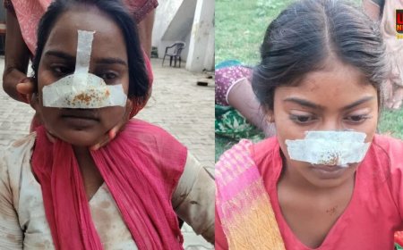 मायके जाने की जिद पर अड़ी पत्नी तो पति ने काट दी नाक,  बेटी का दर्द देख मां ने ससुराल में लिया बदला, काटी दामाद के बहन की नाक