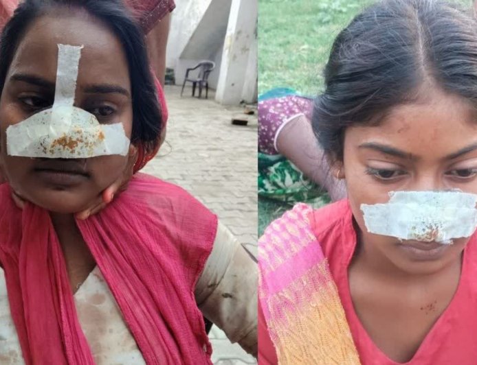 मायके जाने की जिद पर अड़ी पत्नी तो पति ने काट दी नाक,  बेटी का दर्द देख मां ने ससुराल में लिया बदला, काटी दामाद के बहन की नाक