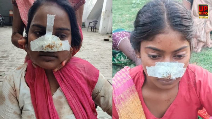 मायके जाने की जिद पर अड़ी पत्नी तो पति ने काट दी नाक,  बेटी का दर्द देख मां ने ससुराल में लिया बदला, काटी दामाद के बहन की नाक